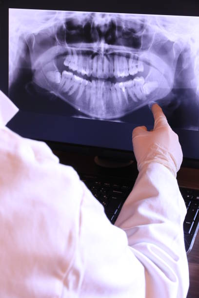 Best Emergency Treatment for Dental Infections or Abscesses in Effingham, IL